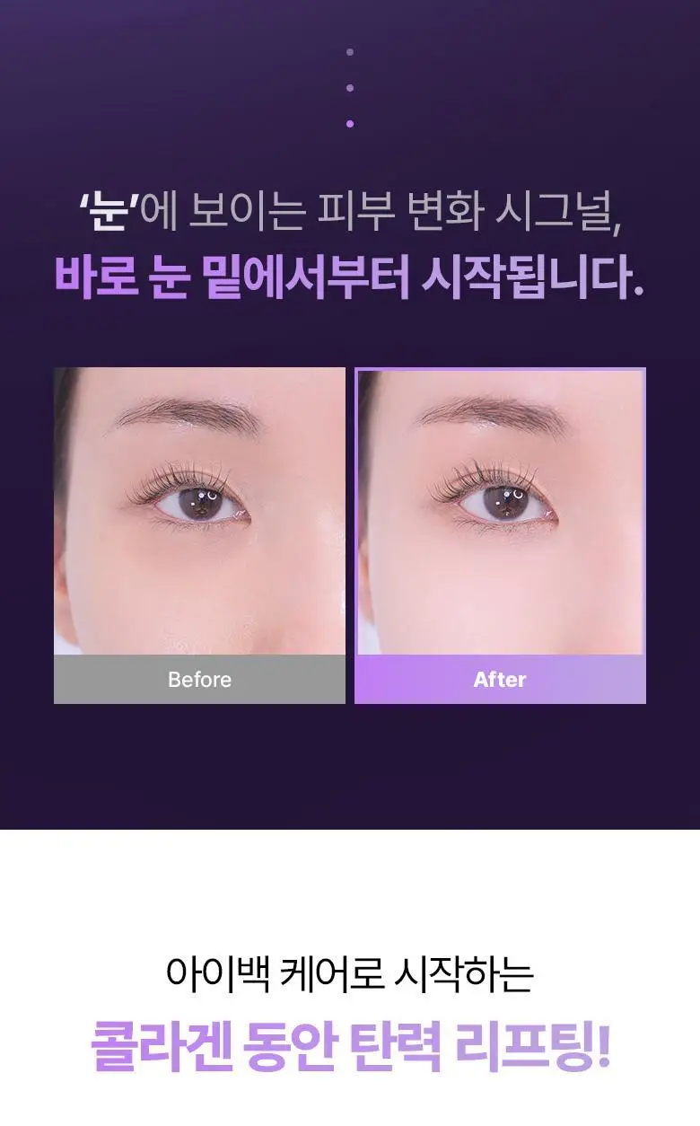 [NEW|아이백리프팅] 바이오힐보 프로바이오덤 콜라겐 PDRN 아이백 & 미간 패치 6,800샷 상세페이지 8